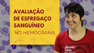 Avaliação de esfregaço sanguíneo no hemograma [upl. by Naej]