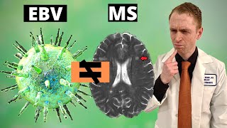 EBV Does Not Cause Multiple Sclerosis [upl. by Eenram]