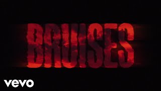 Lewis Capaldi  Bruises Lyric Video [upl. by Standing465]