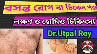 বসন্ত রোগের লক্ষণ ও প্রতিকারহোমিও ঔষধ Chiken pox er lokkhon o homeo madicine DrUtpal Roy [upl. by Truc401]