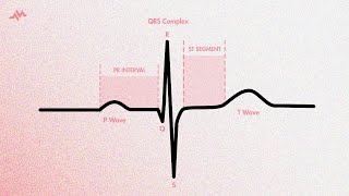 The Cardiac Cycle on an EKG PQRST Waves [upl. by Ulrich]