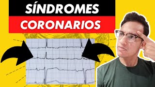 Síndromes coronarios ¿cómo puedo ayudar a mis pacientes SanofiSponsored [upl. by Wollis]