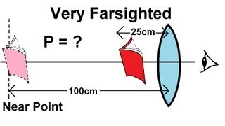 Physics  Optics Vision Correction 5 of 5 Very Farsighted [upl. by Ekihc]