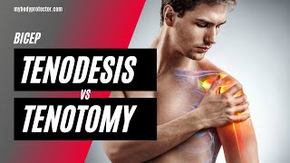 Bicep Tenodesis vs Tenotomy  Dan Orcutt MD Orthopedic Surgeon [upl. by Zahavi506]