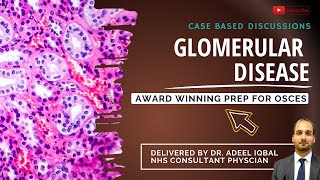 Glomerular Disease  Abdominal  BEST OSCE Preparation for Medical Student Exams [upl. by Merridie]