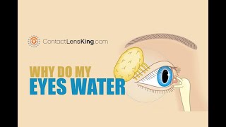 How to Remove Foreign Particles from the Eye Using Water [upl. by Eada]