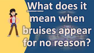 What does it mean when bruises appear for no reason  Frequently ask Questions on Health [upl. by Beaufert162]