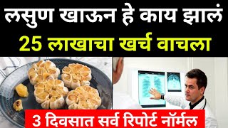 लसुण खाल्यानंतर झाला ऐवढा फायदा Health tips Boost Your Wellness amp Energyआरोग्यआहारdiet [upl. by Boffa]