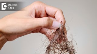 What are causes of severe hair fall like 100 strands daily  Dr Nischal K [upl. by Hanikahs]