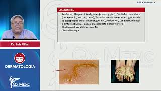 DERMATOLOGÍA Infecciones Acarosis mp4 [upl. by Keryt456]