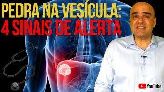 4 sinais e sintomas de alerta para pedra na vesícula [upl. by Eiuqcaj]