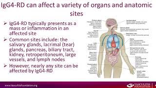 IgG4 Related Disease [upl. by Hterrag]