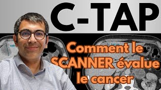 Scanner CTAP pour évaluation et suivi des cancers  cas clinique démonstratif [upl. by Torras]