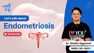 Endometriosis  Causes Symptoms amp Treatment [upl. by Dodge]