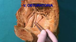 Canalis obturatorius HD [upl. by Noskcaj]