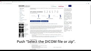 DICOM Library by Softneta upload anonymize view share and download anonymized DICOM files online [upl. by Sucramej]