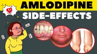 Amlodipine Side Effects amp How to Avoid  Amlodipine Adverse Effects [upl. by Nnylaf756]