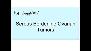 Mucinous Cystadenoma Ovary  Histopathology [upl. by Nalym]