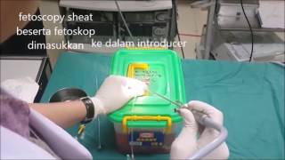 Fetoscopy training amp simulation [upl. by Ivory]