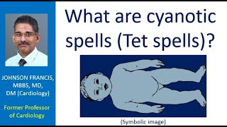 What are cyanotic spells Tet spells [upl. by Akiemat]