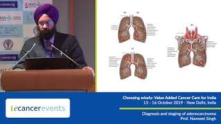 Diagnosis and staging of lung adenocarcinoma [upl. by Neerbas]