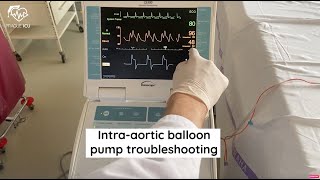 Intraaortic balloon pump troubleshooting [upl. by Nnaeirb]