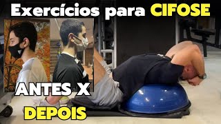 Cifose como corrigir com exercícios de musculação  hipertrofia  Otto [upl. by Arvy]