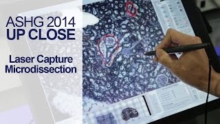 Introduction to Laser Capture Microdissection LCM  ASHG 2014 [upl. by Desberg892]