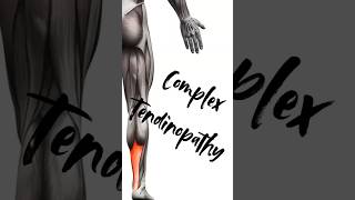 letstalkabout complex tendinopathy sports sportsmedicine sportsdoctor sportsinjury fyp [upl. by Theodor]