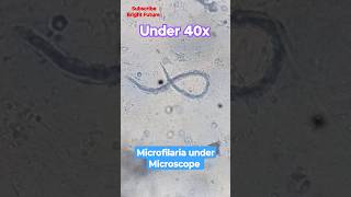 Microfilaria under microscope 🪱🪱 medical laboratory [upl. by Perrin]