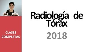 Radiología de Tórax  Videoclase completa 2018 [upl. by Nassah861]