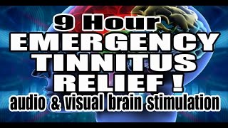 TINNITUS RELIEF Violet Noise  Neuromodulation  Visual Stimulus [upl. by Haberman607]