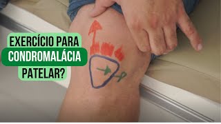 🦵 Exercício para condromalácia patelar [upl. by Pike]