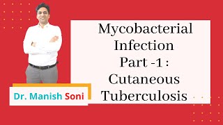 Mycobacterial infections part1  Cutaneous Tuberculosis  Mycobacterial Disease  Dr Manish Soni [upl. by Recha]