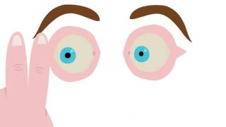 How EMDR works Look at this animation English [upl. by Silvia]