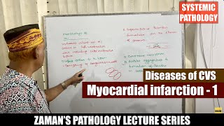 Systemic Pathology Lecture 35  Diseases of CVS  Day 05  Myocardial infarction  01 [upl. by Nnod134]