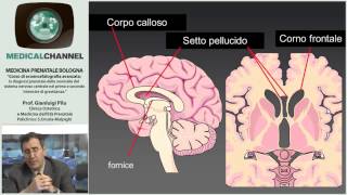 Ecoencefalografia Fetale  Corso Avanzato Esclusiva [upl. by Nakhsa260]