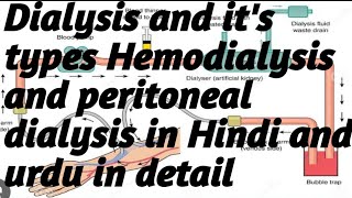 Dialysis and its types Hemodialysis and peritoneal dialysis in HindiUrdu in detail [upl. by Peterson]