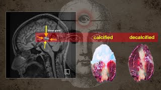 I finally decalcified my pineal gland Heres how [upl. by Billye452]