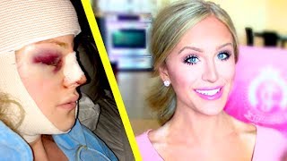 My Facial Plastic Surgery Story  Gigi [upl. by Chaney]