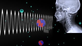 How Do Xrays Work [upl. by Rubie258]