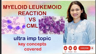 LEUKEMIACML vs LEUKEMOID REACTION VIMP topic for ugpg neetpg inicet pathologyconcepts [upl. by Annayi674]