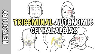 Severe headaches  Understanding Trigeminal Autonomic Cephalgias  types pathophysiology treatment [upl. by Jerusalem]