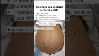 Spontaneous bacterial peritonitis [upl. by Htiekel]