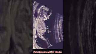 Fetal Movement 24 Weeks [upl. by Aisetra]