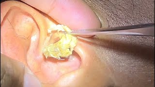 ASMR Ear cleaning care is very satisfying耳掃除ケアは大満足 những chú vịt con trên sa mạc [upl. by Huang]