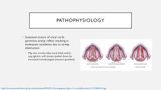 Common Perioperative Complications Keyword Review  Dr Green [upl. by Boggers90]