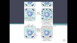 Parenchymal Stromal  Vascular Dystrophiesamp Mixed DystophiesCalcification pathology [upl. by Andrus]