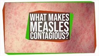 Why Is The Measles Virus So Contagious [upl. by Emery]