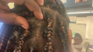 Dandruff scratching dandruff braids fyp scratching itchyscalp dandrufftv [upl. by Rentschler585]